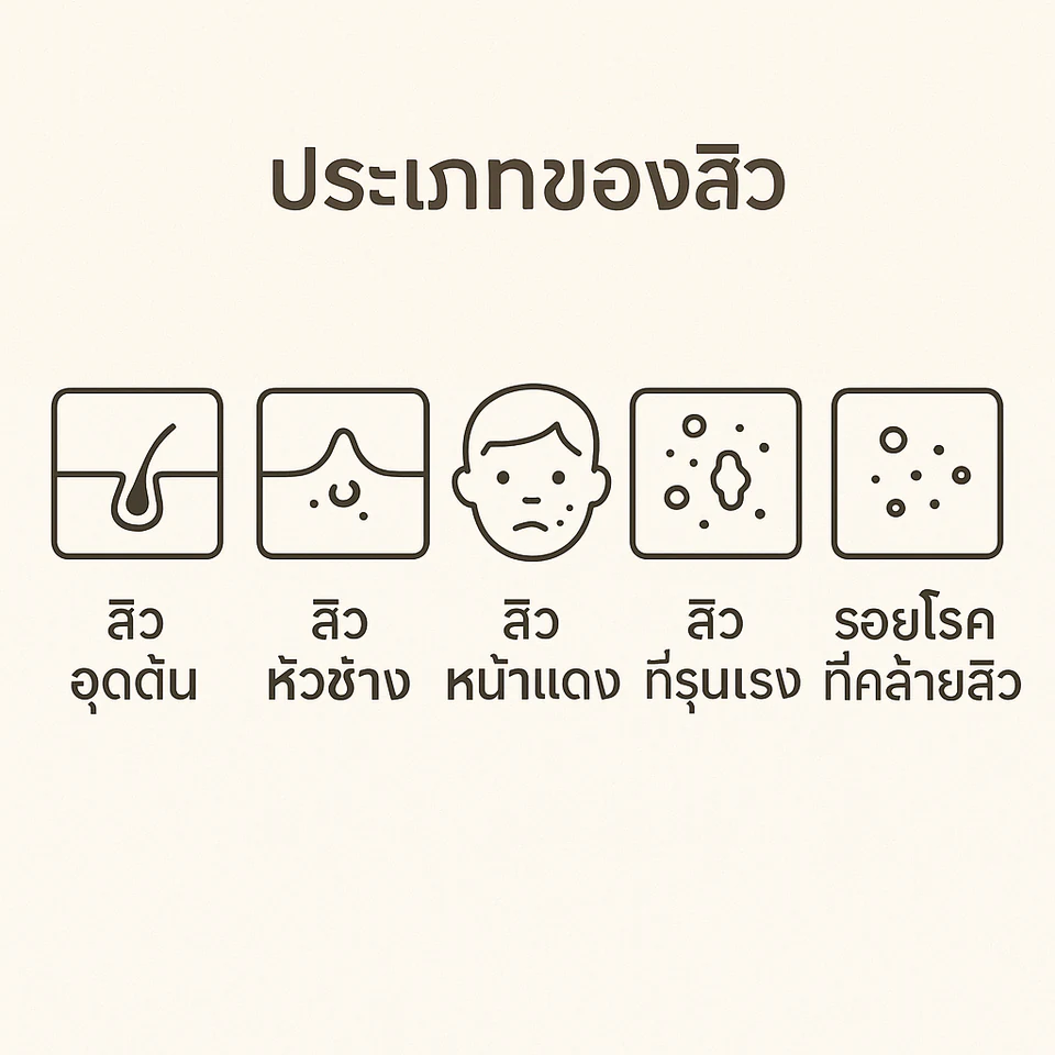 แผนภาพหัวข้อสิวอุดตัน สิวหัวช้าง สิวหน้าแดง สิวรุนแรง และรอยโรคที่คล้ายสิว