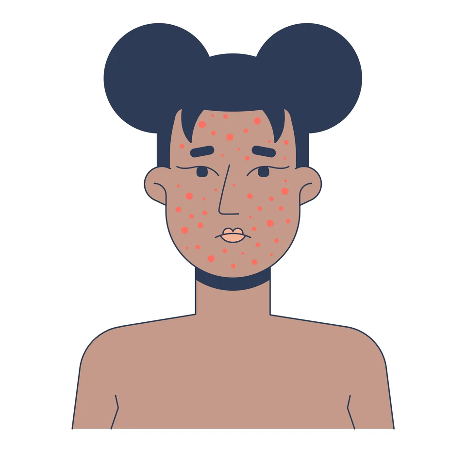 ภาพวาดบุคคลที่มีตุ่มบนใบหน้า